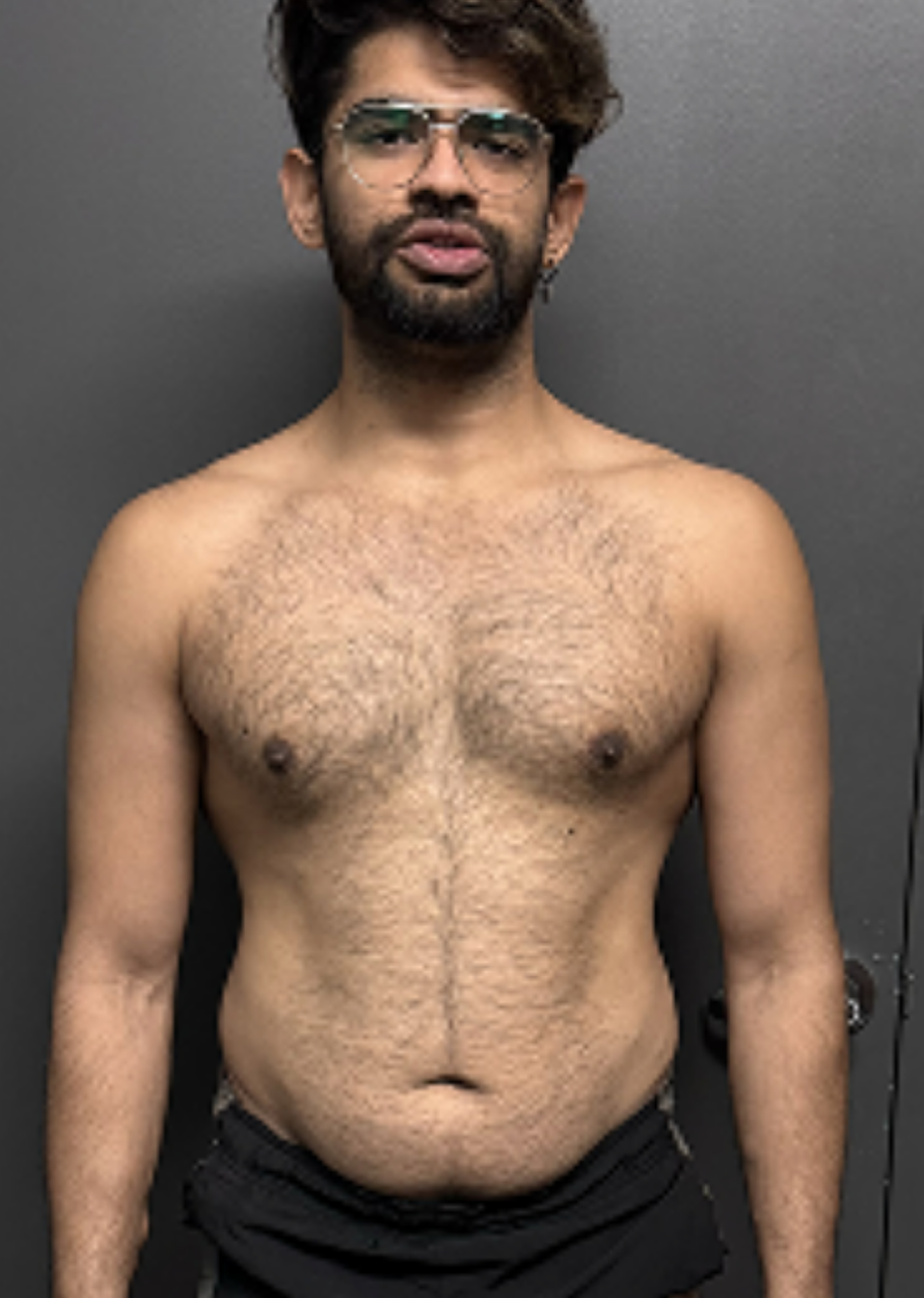 Client transformation 08 before coaching