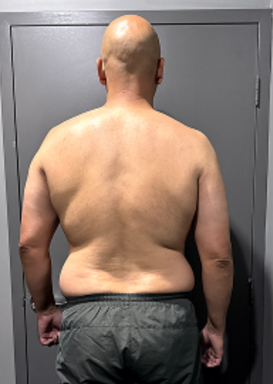 Client transformation 06 before coaching